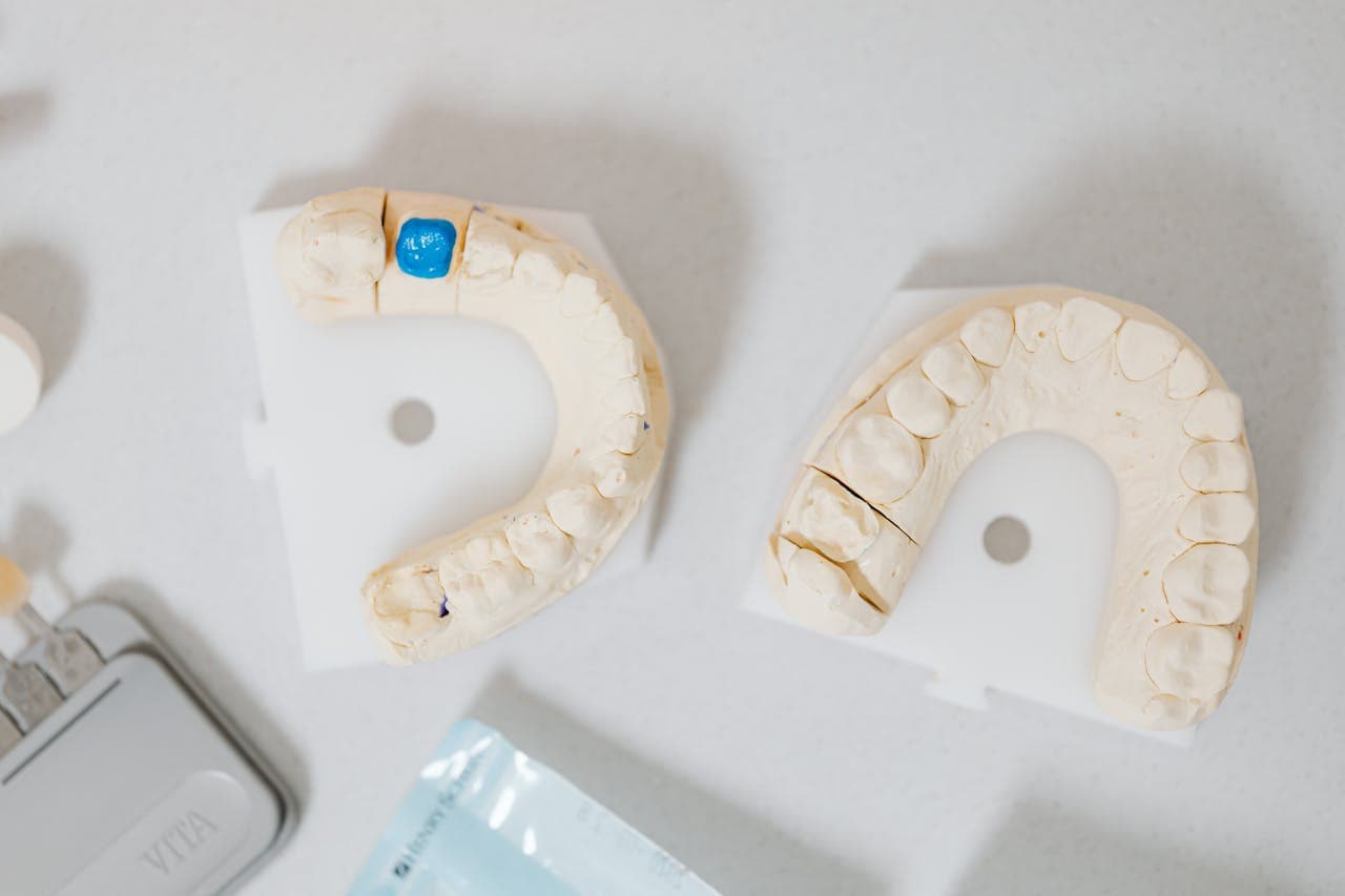 Restorative dental care consultation for crowns bridges and implants in Florence KY